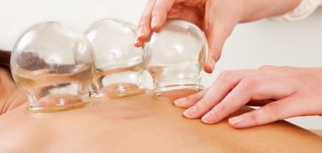 ما هي الحجامة وما فوائدها