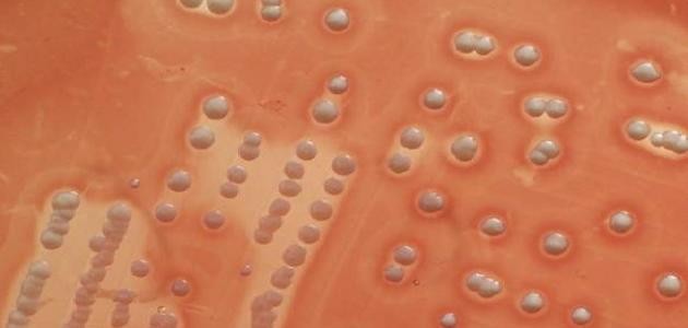 ما هو تسمم الدم