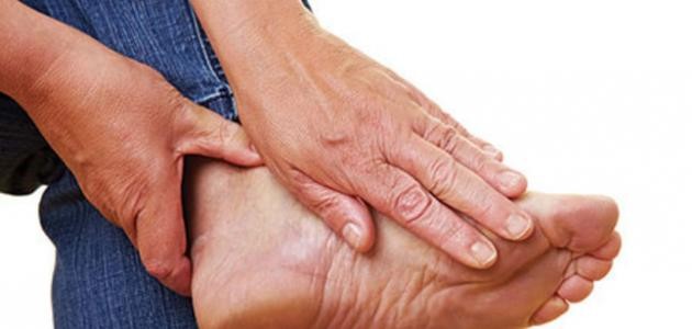 ما هو داء الملوك