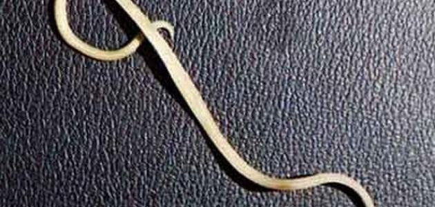 كيف تتخلص من دودة الاسكارس