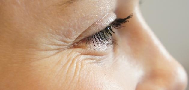 إزالة تجاعيد الوجه نهائياً