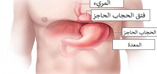 فتق الحجاب الحاجز و أنواعه فتق الحجاب الحاجز و أنواعه