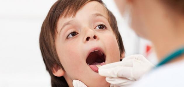 ما هو علاج بحة الصوت ما هو علاج بحة الصوت