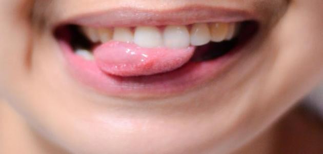 ما أسباب ثقل اللسان