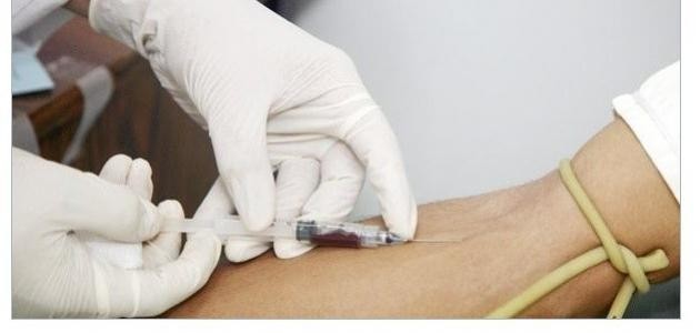 ما هو تحليل Hb Electrophoresis