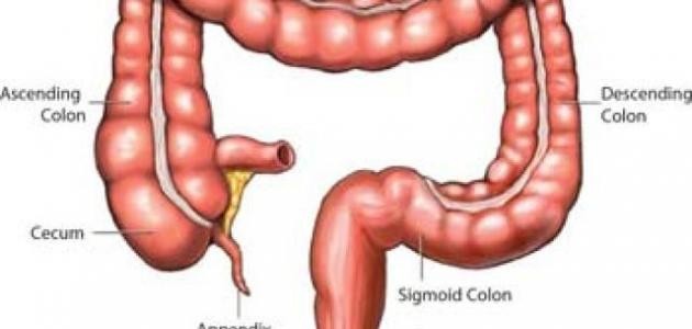 ما هي أعراض المصران الأعور