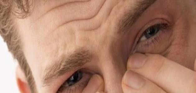 ما هي لحمية الانف