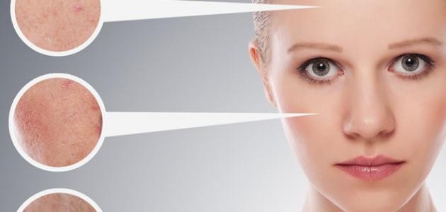 كيفية الاهتمام بالبشرة الدهنية