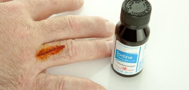 ما هي صبغة اليود