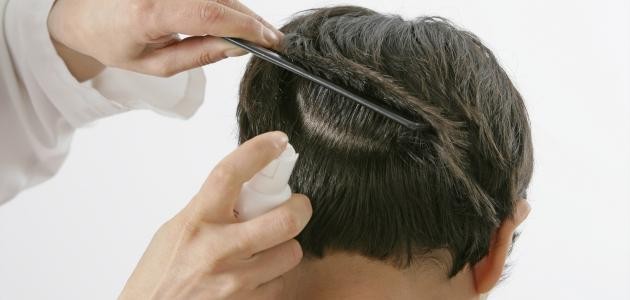 ما هو علاج القمل وبيضه