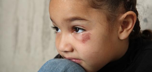 سوء المعاملة للأطفال