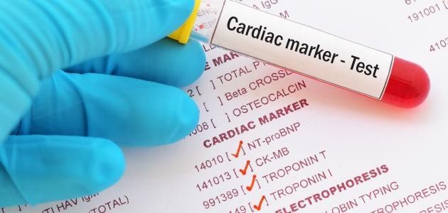 ما هو تحليل إنزيمات القلب