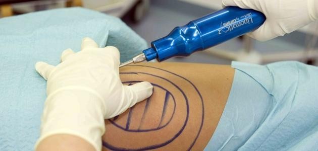 أحدث وسائل التخسيس